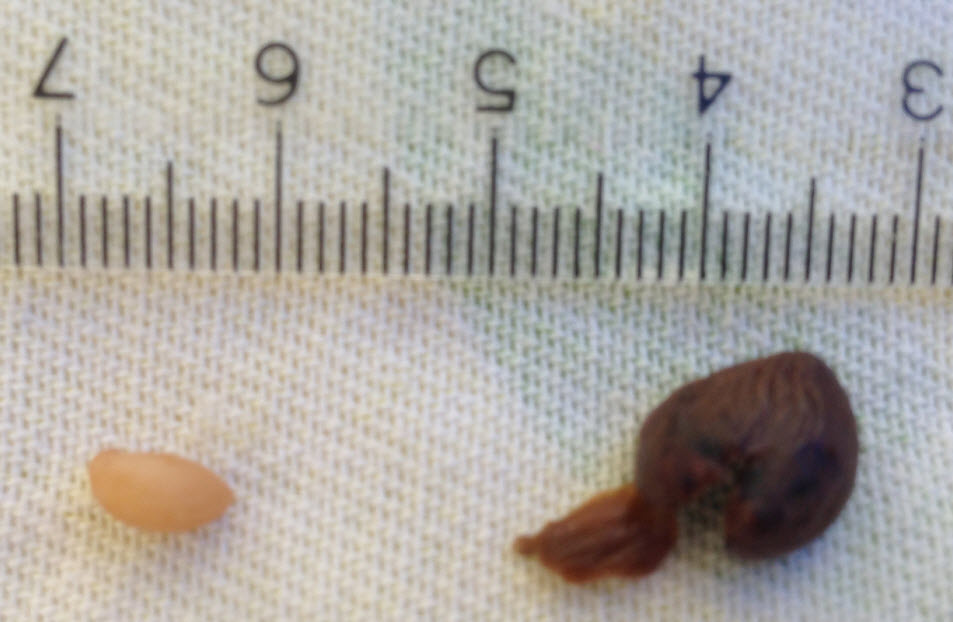 Dypsis Pinnatifrons a.jpg